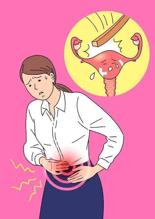 فیبروم رحم از صفر تا صد؛ فیبروم دقیقاً چیست؟ | برای درمان فیبروم رحم چه باید کرد؟ | آیا داشتن فیبروم به معنی ناباروری است؟ فیبروم رحم از صفر تا صد؛ فیبروم دقیقاً چیست؟ | برای درمان فیبروم رحم چه باید کرد؟ | آیا داشتن فیبروم به معنی ناباروری است؟